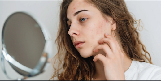 Winter Skincare: How to Keep Your Skin Healthy and Hydrated