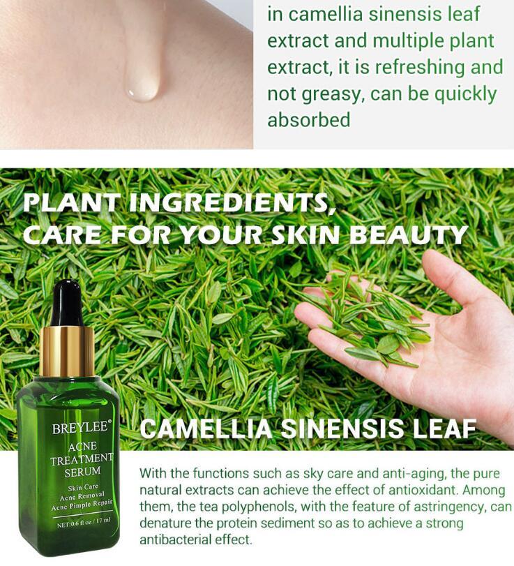 Facial Repair Oil | Acne Treatment Serum | Skin Versaa