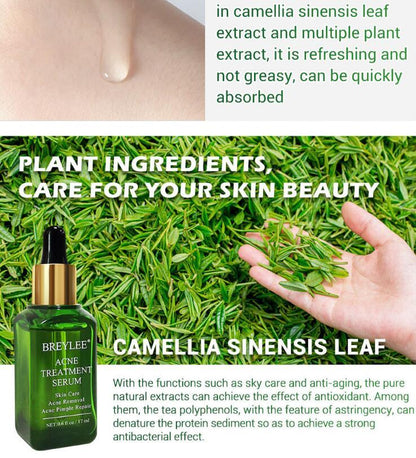 Facial Repair Oil | Acne Treatment Serum | Skin Versaa