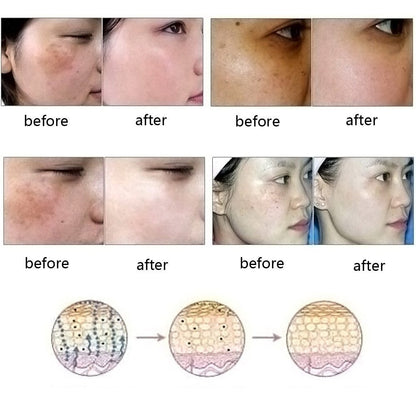 Scar Removal Oil | Marks Removal Oil | Skin Versaa