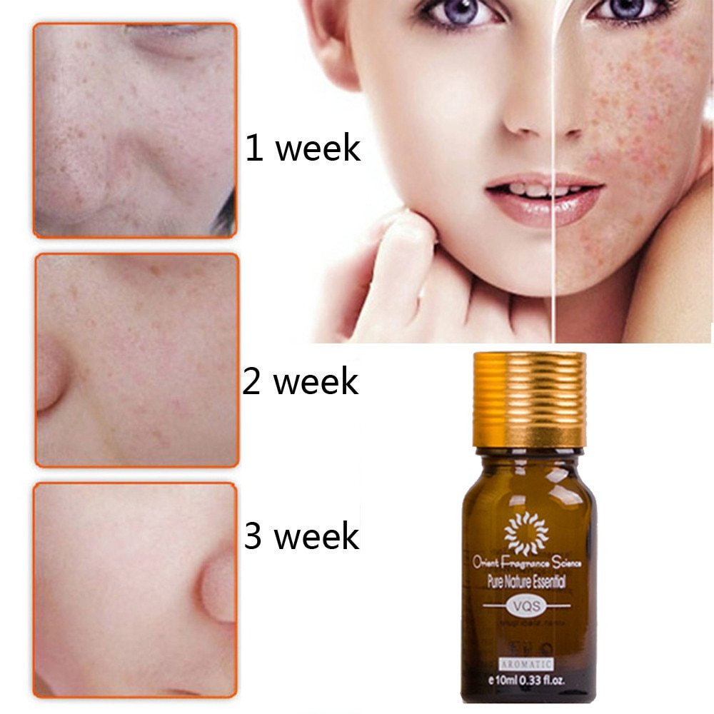 Scar Removal Oil | Marks Removal Oil | Skin Versaa