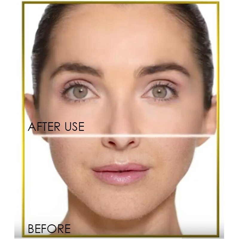 Facial Hair Remover | Hair Remover Razor | Skin Versaa