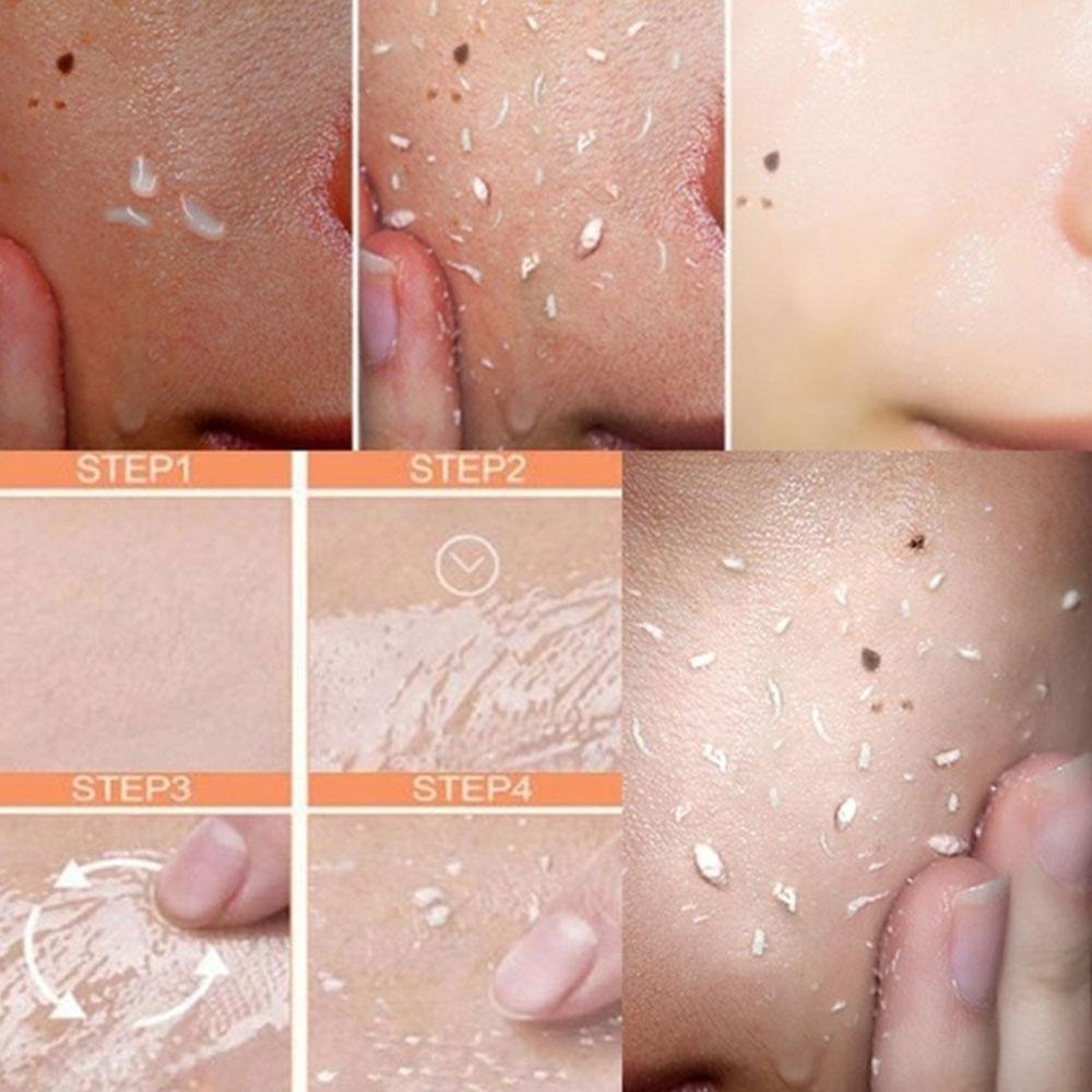 Facial Exfoliating Gel | Face Saver Gel | Skin Versaa