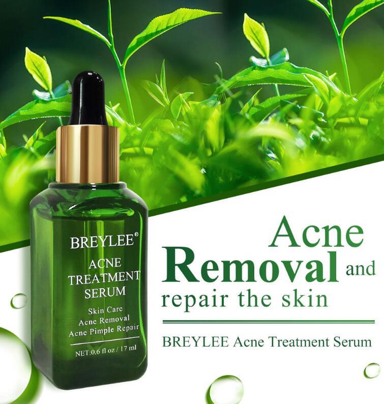 Facial Repair Oil | Acne Treatment Serum | Skin Versaa