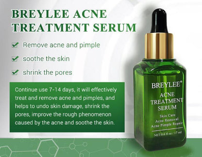 Facial Repair Oil | Acne Treatment Serum | Skin Versaa