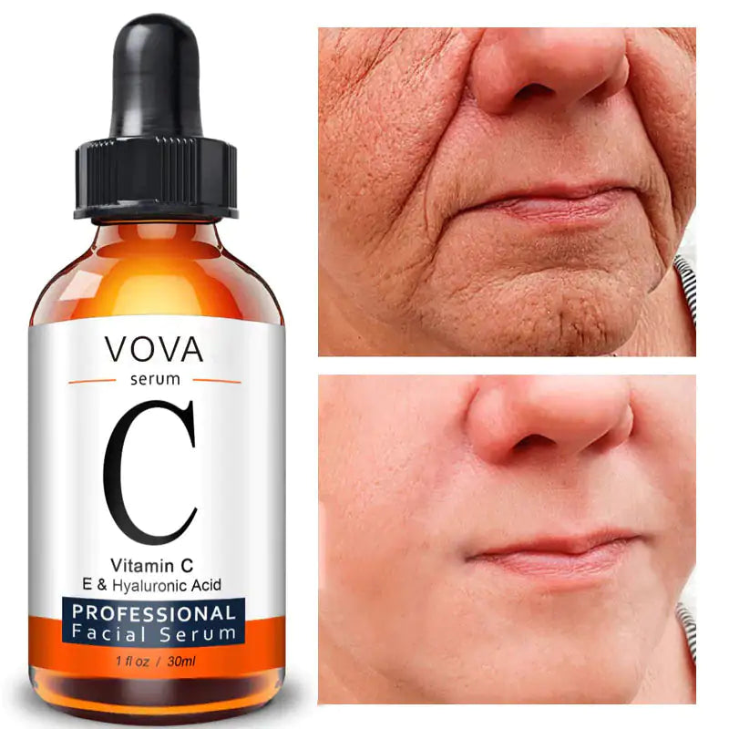 Anti Wrinkle Serum | Vitamin C Serum | Skin Versaa